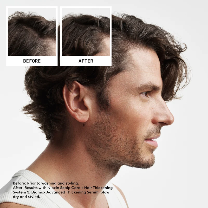 Nioxin System 2 Treue-Kit