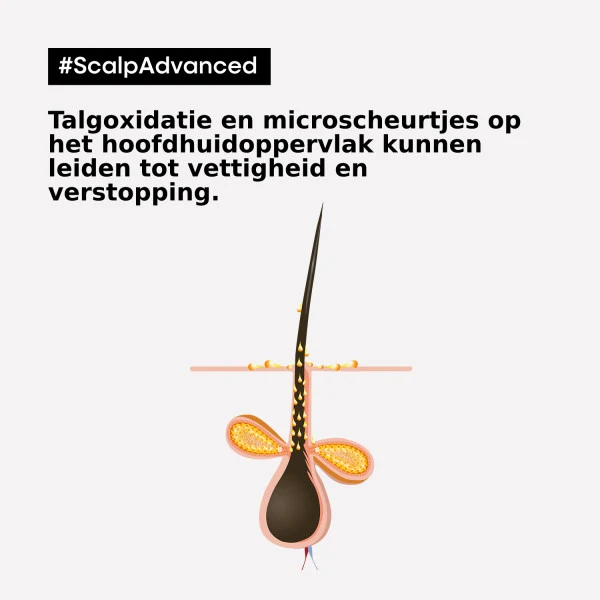 L'Oréal Professionnel Scalp Advanced Anti-Öligkeit 2-in-1 Tiefenreiniger Tonerde 250ml