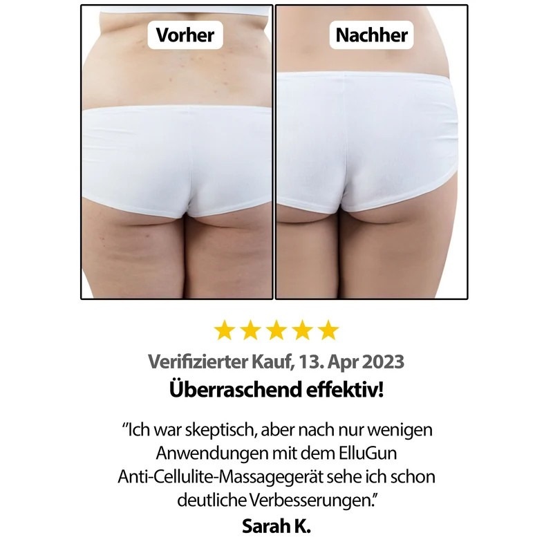ELEKJACK® Anti-Cellu Massagepistole